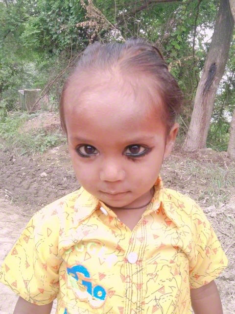 World Vision India